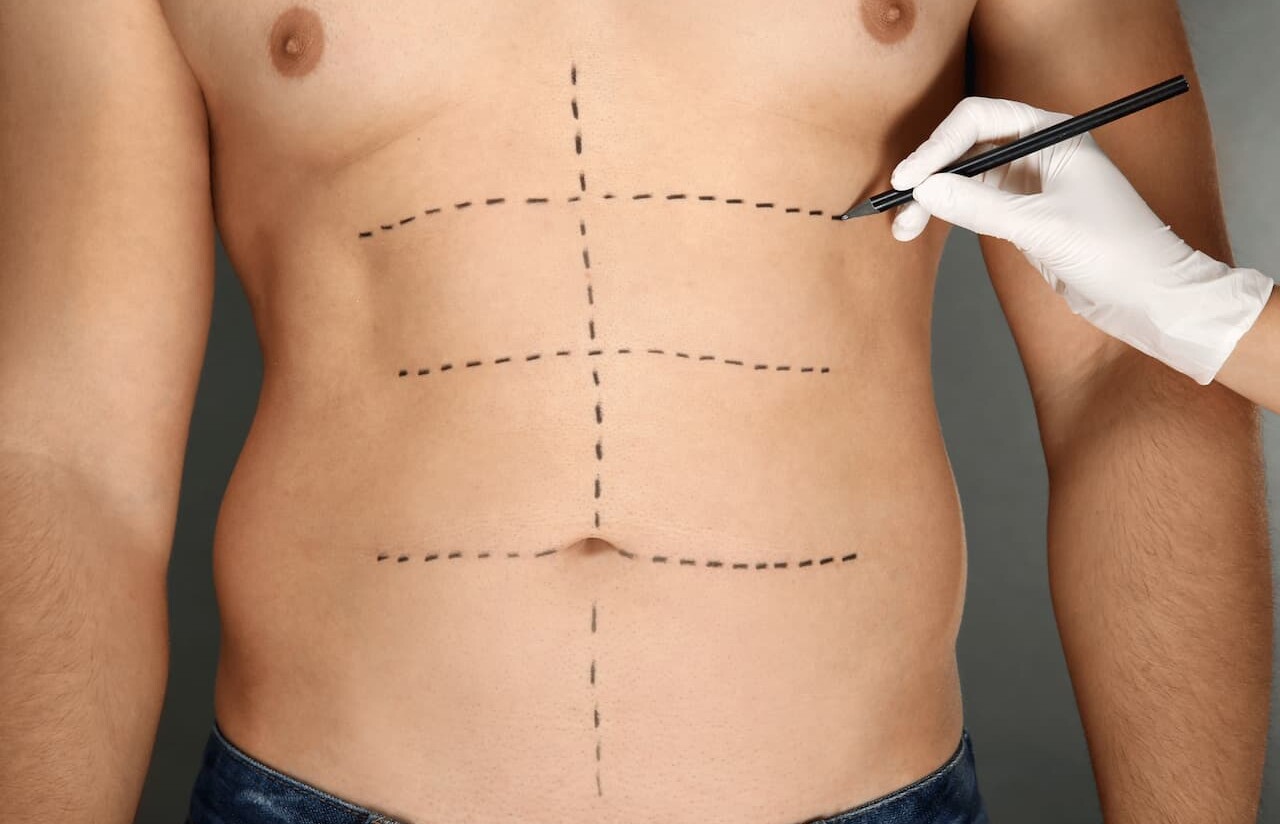 Cresce no Brasil a procura masculina por cirurgias plásticas