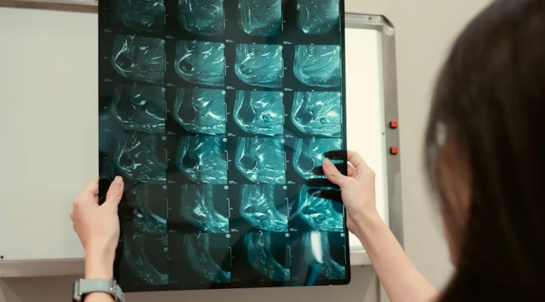 Câncer: cinco mitos sobre alimentação, repouso e vacinas que podem prejudicar a recuperação