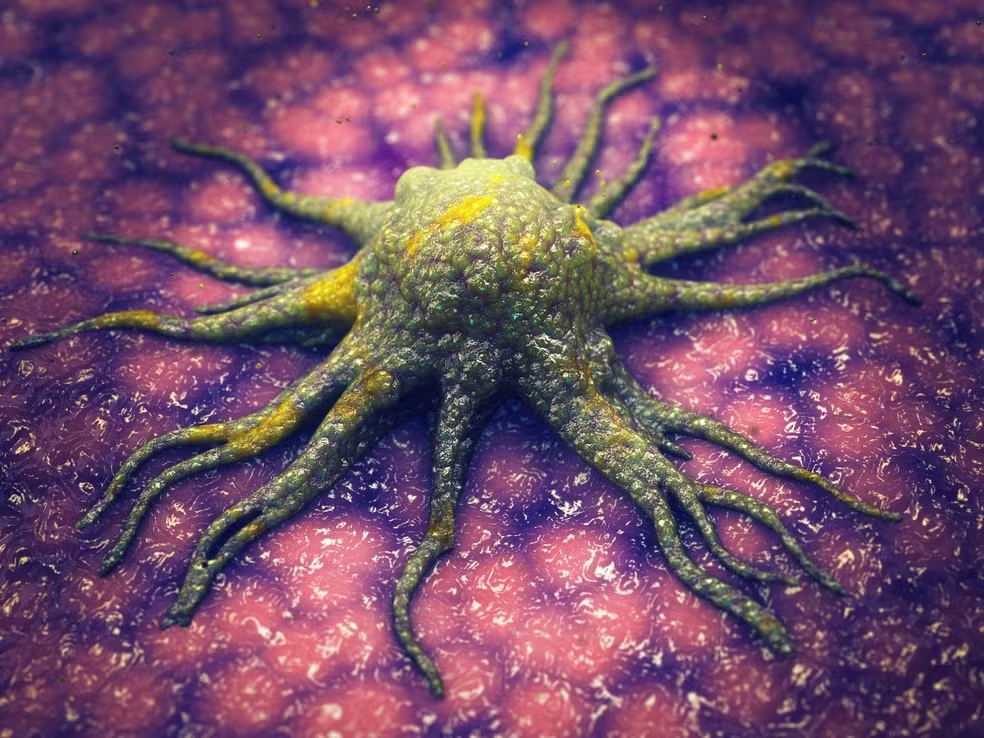 Ilustração com visão artística de célula cancerígena - Foto: AdobeStock