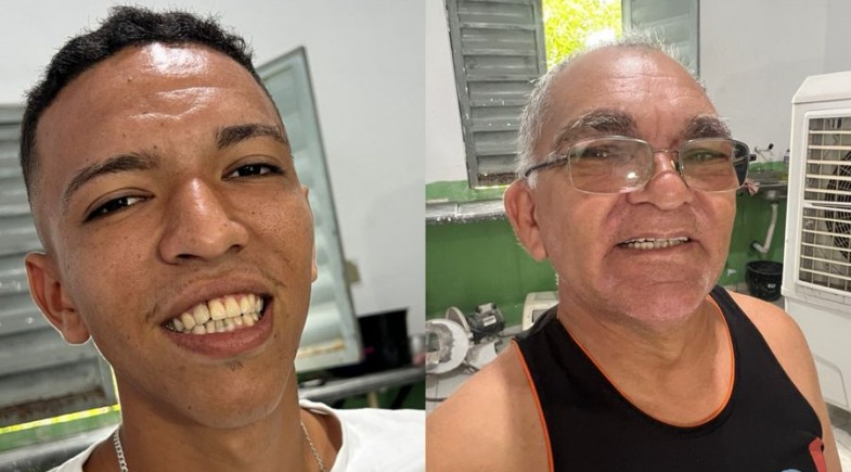 Pau D’Arco realiza entrega de próteses e reforça cuidado com a saúde bucal da população