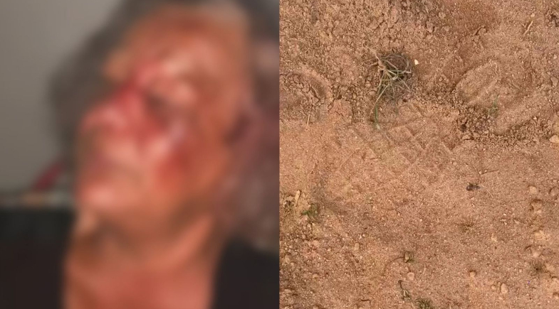 Imagens divulgadas por familiares mostram pegadas próximas ao local e rosto machucado da vitima | Foto: Reprodução/Redes Sociais