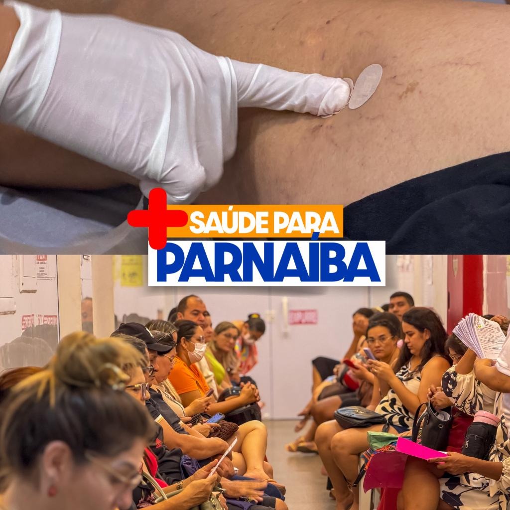 Parnaíba realiza mutirão de varizes e ultrapassa 4 mil procedimentos - Divulgação/ASCOM